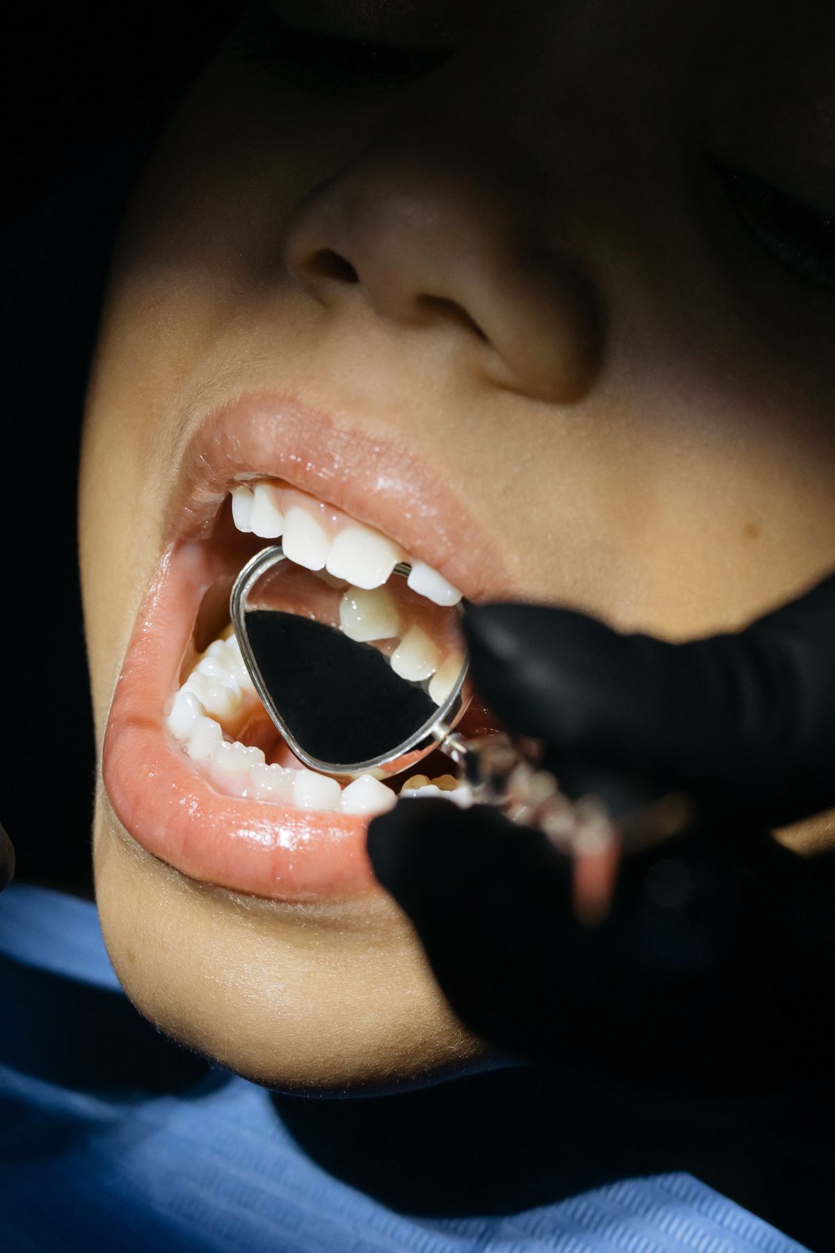 Interceptive Orthodontics for Children