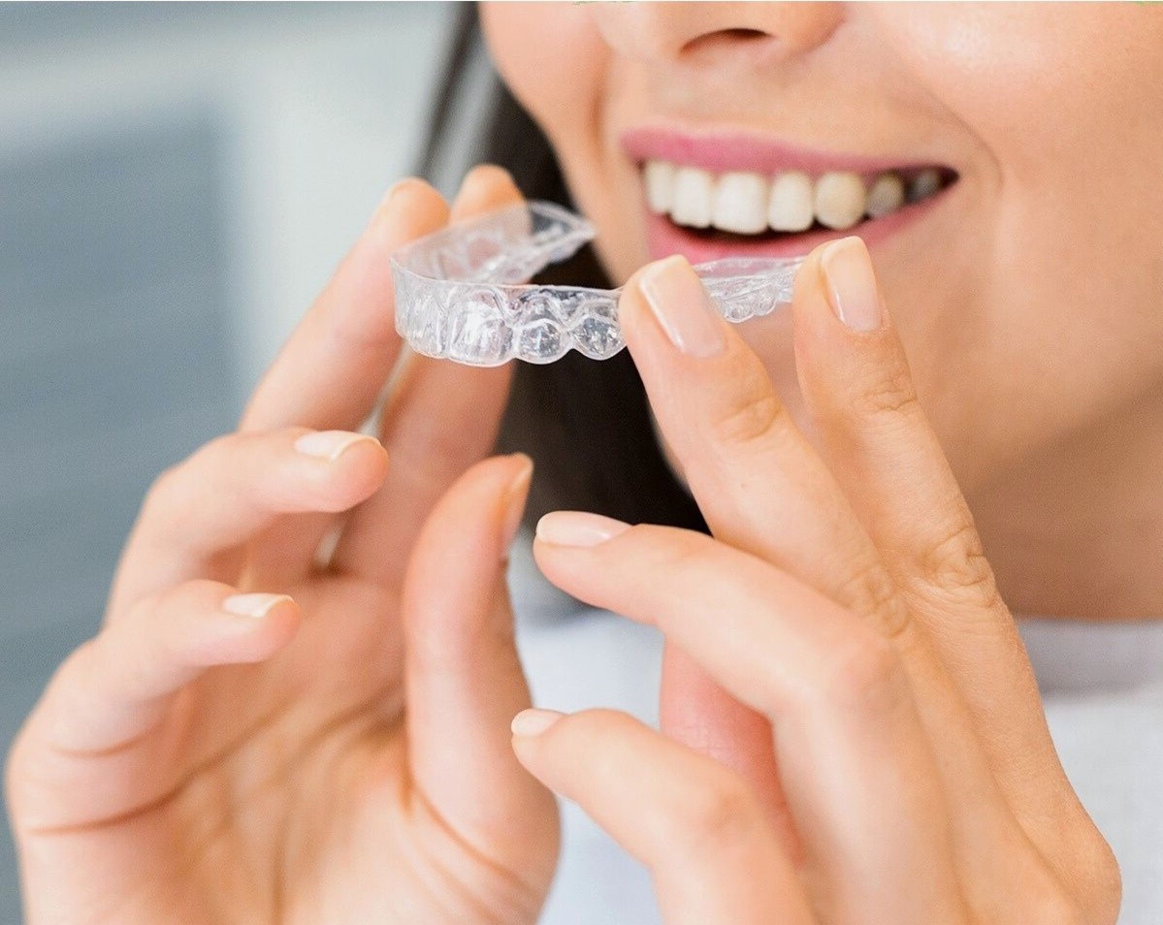 Retainers After Braces