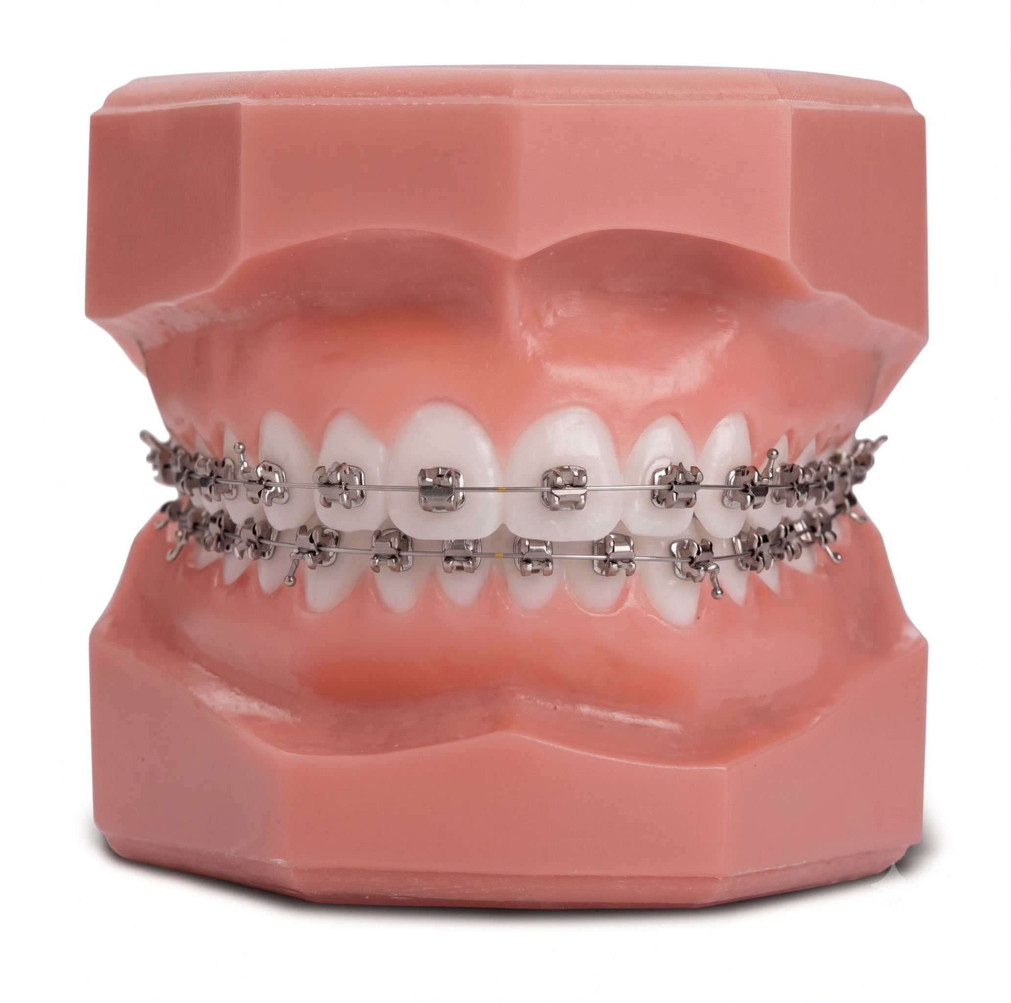 Self-Ligating Braces
