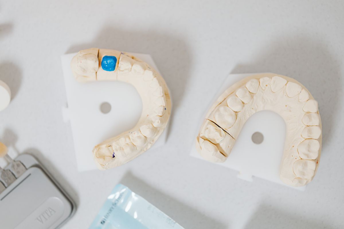 Dental Crowns & Bridges
