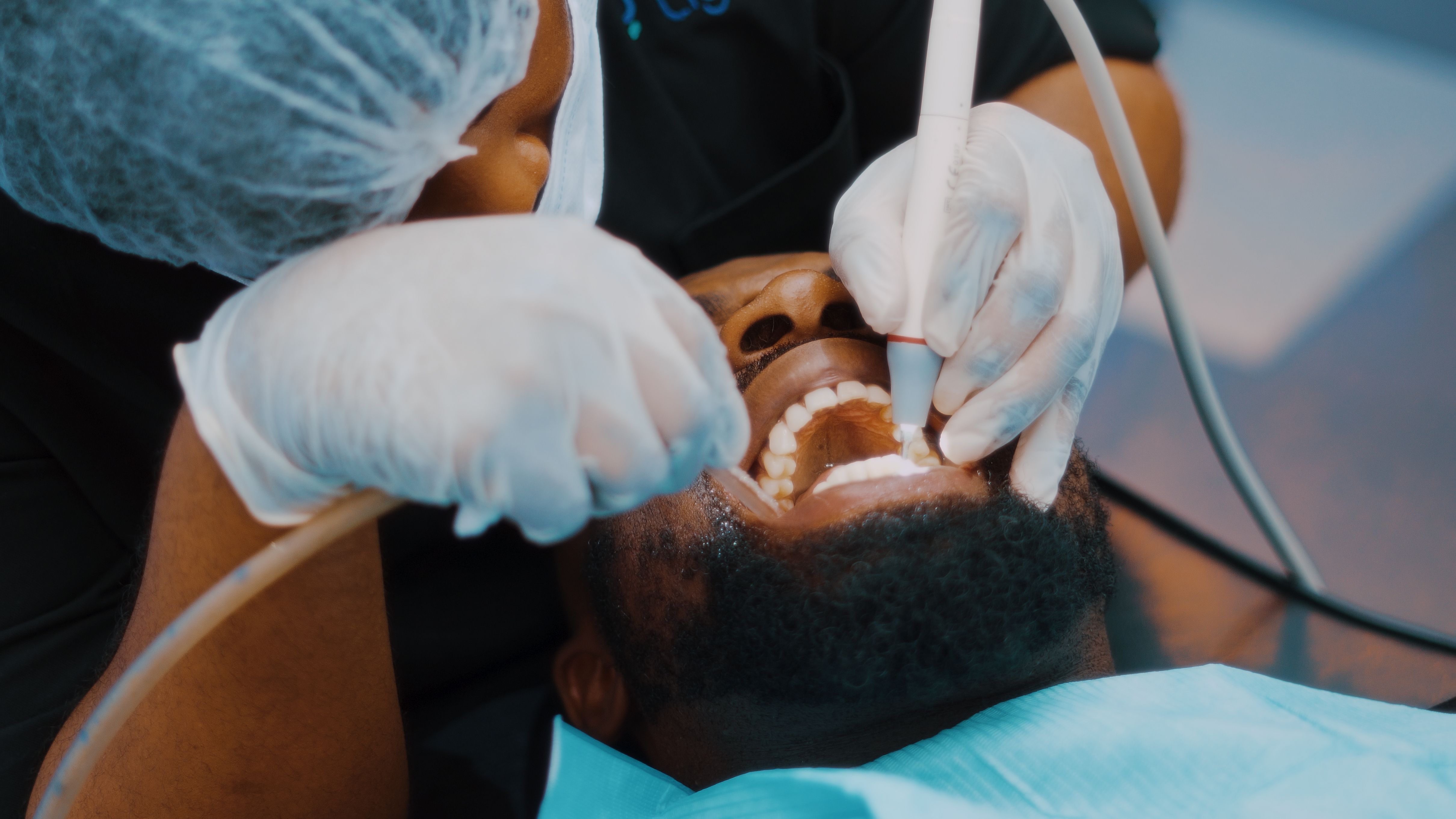Teeth Cleaning & Scaling