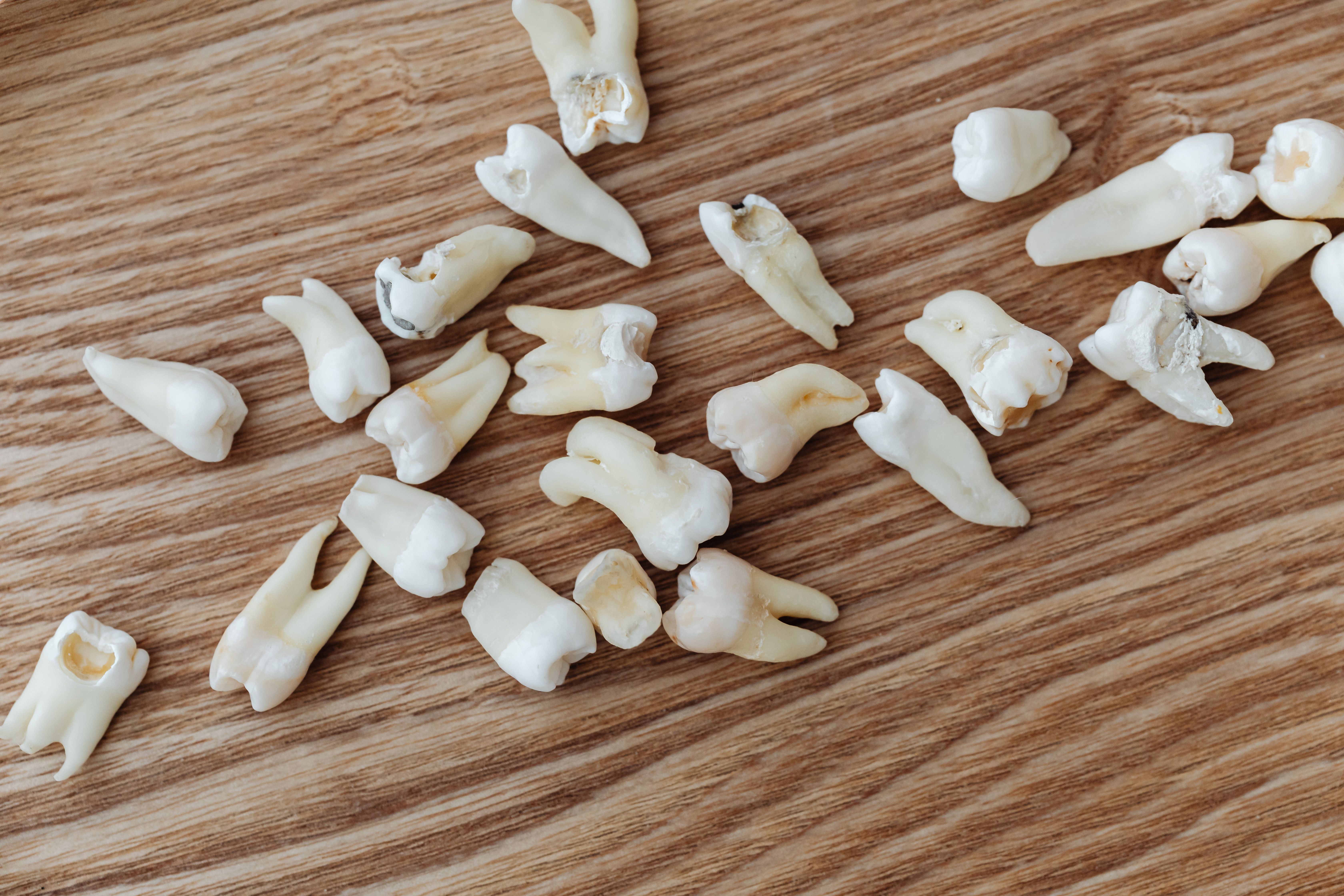 Tooth Extraction